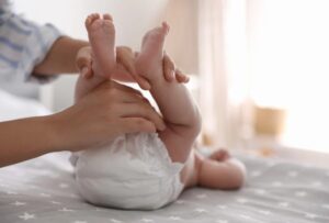 Baby Diaper Rash: Causes and Care Tips