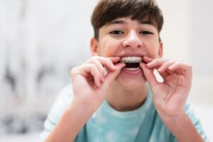 Baby Teeth vs. Mixed Dentition Braces: When Should Kids Start Orthodontic Treatment?