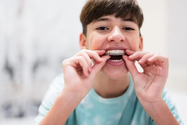 Baby Teeth vs. Mixed Dentition Braces: When Should Kids Start Orthodontic Treatment?