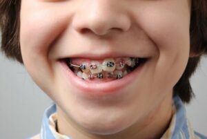 What to Know Before Your Child’s First Orthodontist Visit