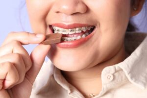 Foods Kids Should Avoid with Braces
