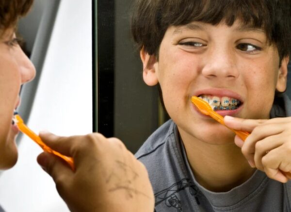 How Should Kids Brush Their Teeth with Braces?