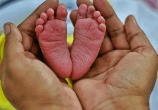 10 Common Conditions in Newborns with Tips and Warning Signs