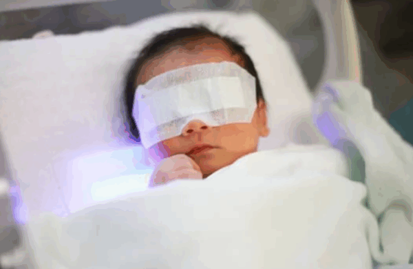 Newborn Jaundice: What Parents Should Know