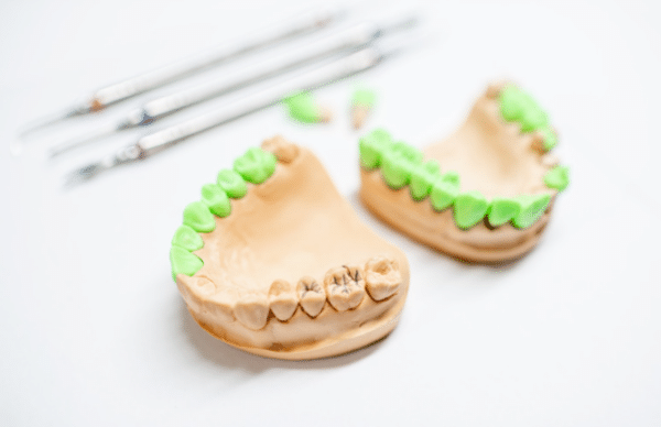 Can a 7-Year-Old Get Braces?