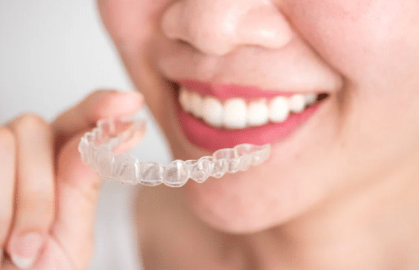 Teen Braces Cost Guide: What Parents Can Really Expect to Pay