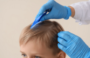 Head Lice Prevention: Simple Tips to Protect Kids at School