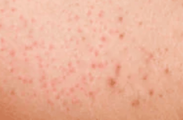 Baby Face Rash: 6 Common Causes Every Parent Should Know