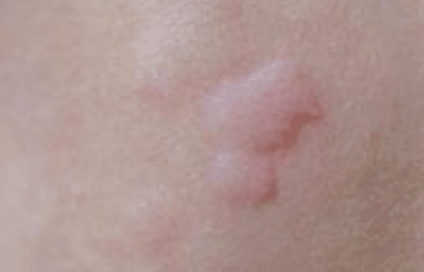 Baby Face Rash: 6 Common Causes Every Parent Should Know