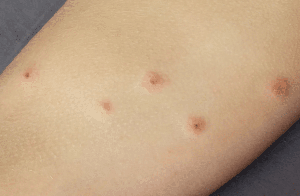 Baby Face Rash: 6 Common Causes Every Parent Should Know