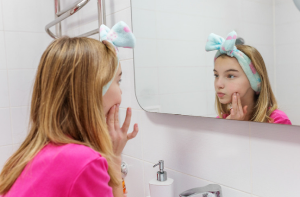 Why Does My Daughter Suddenly Have Acne?